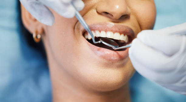 Best Urgent Care for Lost Fillings or Crowns in Menlo Park, CA